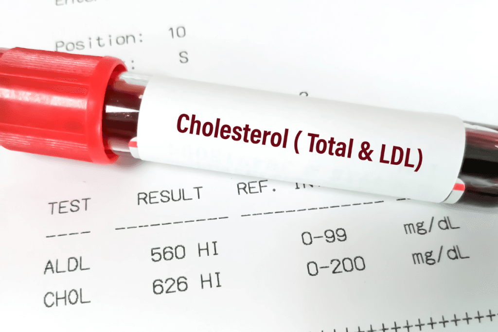 High Cholesterol