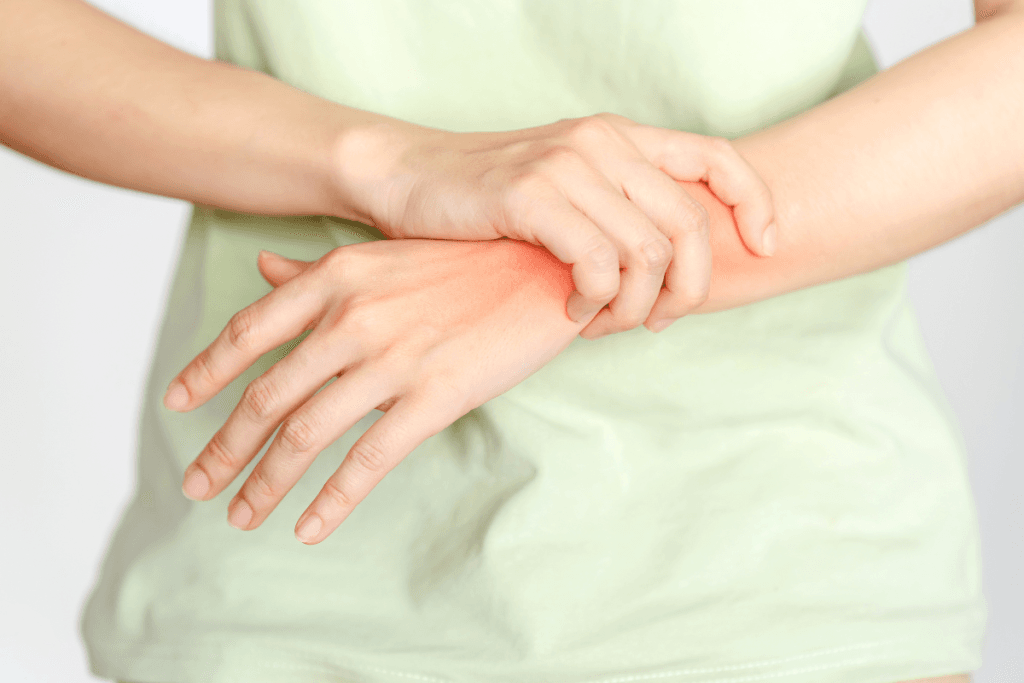 Arthritis