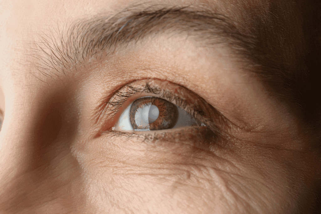 Cataract Awareness Month