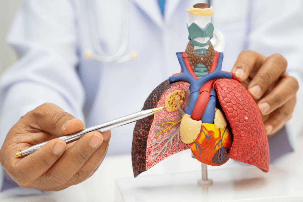 Lung Cancer Awareness Month